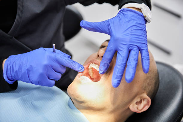 Best Broken or Chipped Tooth Repair in Lawnside, NJ